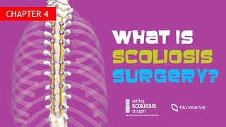 Ch 4  What is Scoliosis Surgery [upl. by Sacks838]