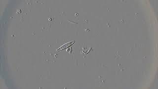 Diatoms in action [upl. by Anen]