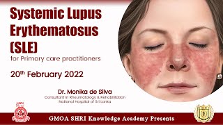 Systemic Lupus Erythematosus SLE for Primary care practitioners  Dr Monika De Silva [upl. by Nance102]