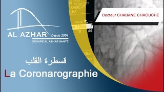 La Coronarographie قسطرة القلب [upl. by Aizahs]