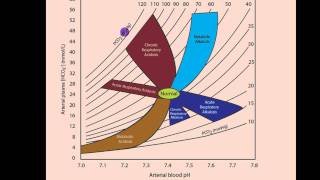 Part 2 Acidosis and Alkalosis Metabolic or Respiratorymp4 [upl. by Aham]