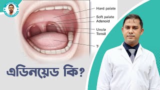 এডিনয়েড হলে কি কি সমস্যা হয় What are Adenoids Tonsils and Adenoids Operation [upl. by Ytissac89]