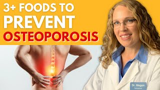 3 Foods to Prevent Osteoporosis [upl. by Belier]