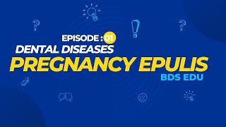 Pregnancy Epulis  Dental Diseases  Episode  01 BDS Edu [upl. by Ruben995]