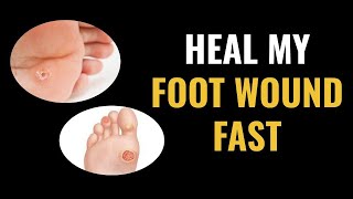 How Do I Heal My Foot Wound Fast  Introduction [upl. by Aihsar]