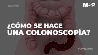 ¿Cómo se hace una colonoscopía ExclusivoMSP [upl. by Drugi]