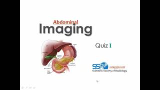 34 Abdominal imaging Quiz Cases Prof Dr Mamdouh Mahfouz [upl. by Yerhpmuh]