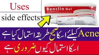 Benclin Gel Review  Benclin Gel Uses In Urdu Benzoyl Petoxide Benefits Uses [upl. by Krenek884]