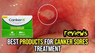 🌟 Banish Canker Sores FAST Top 3 Treatments Reviewed amp How to Use Them 🔥 [upl. by Locke]