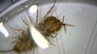 microscope video of asellus aquaticus waterlouse aquatic sowbug  Wasserassel unterm Mikroskop [upl. by Emalia420]