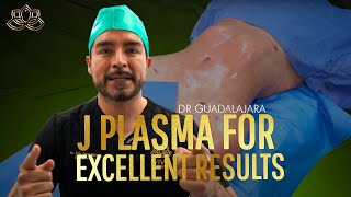 Lipo 360 with J Plasma Dr Guadalajara ✨ Patient gets shocking BBL Results🍑 Vive Plastic Surgery [upl. by Emmet]