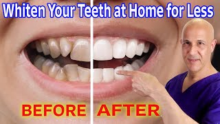 Whiten Your Teeth at Home for Nearly Free Dr Mandell [upl. by Dorfman]