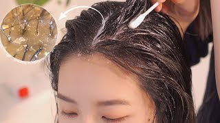 ASMR 시원한 두피 마사지스케일링빗질  Scalp Massage and Scalp Scaling [upl. by Lleder]