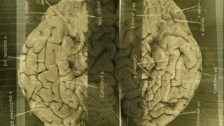 Images of Einsteins brain revealed [upl. by Jameson]