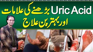 Uric Acid Symptoms and Treatment  Uric Acid Diet Plan and Foods To Avoid  Uric Acid Ka ilaj [upl. by Hourigan399]