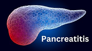 Pancreatitis Everything You Need To Know [upl. by Halbert124]