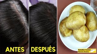 Convierte Las Canas En Cabello Negro Después De Usar Este Remedio Casero – 100 Natural [upl. by Pinchas]