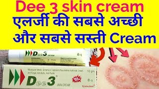 Dee 3 Skin Cream Full EeviewUsesSide Effect कैसे इस्तेमाल करे [upl. by Treble75]