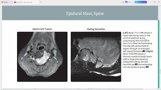 EXPERT DDX BRAIN AND SPINE IMAGING [upl. by Nishom]