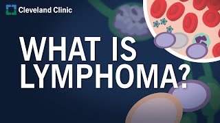 What Is Lymphoma [upl. by Eimaj]