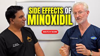 The Side Effects of Minoxidil  The Hair Loss Show [upl. by Olivie550]