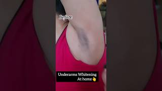 Underarms Whitening At HomeDark Underarms Treatment viralshortsytshortsyoutube skincarebeauty [upl. by Anattar]