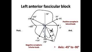 ECG course Fascicular Blocks Dr Sherif Altoukhy [upl. by Notnek]