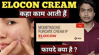 elocon cream  for dark spots  ke fayde  kaise use kare  use in hindi [upl. by Eniagrom15]