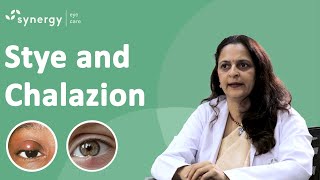 What is a Stye What is a Chalazion Whats are the causes and how can we prevent it [upl. by Eul]