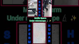 Semen analysis  Under microscope shorts youtubeshorts microscope viral sperm [upl. by Nosnhoj]