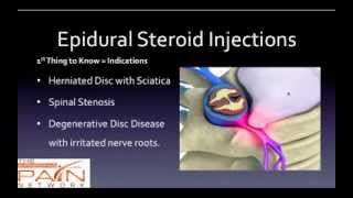 5 Things to Know About Epidural Steroid Injections 602 5076550 [upl. by Estelle]