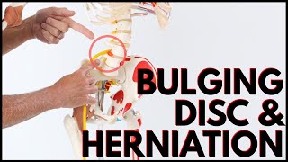 Best Exercise for L4L5 Disc Bulge amp L4L5 Herniation Includes Self Tests [upl. by Juli]