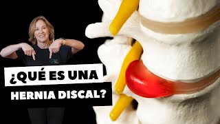 ¿QUÉ ES UNA HERNIA DISCAL [upl. by Elleirda858]