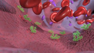 C4D 3D animation Hemolytic Uremic Syndrome [upl. by Wally171]