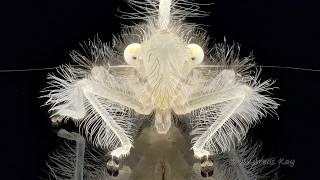 Ballet of a Leafhopper Nymph from Ecuador [upl. by Asreht]