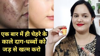 चेहरे के काले दागधब्बे झाइयांनिशान दूर करने की सबसे तेज Cream Dark Spots on face removal [upl. by Beore]