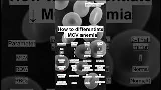 How to differentiate ↓ MCV anemia [upl. by Ajiam330]