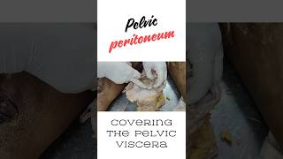 Peritoneum covering the pelvic viscera pelvic cellular tissue shorts peritoneal pelvis [upl. by Haberman]