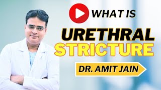 Urethral Stricture Causes Treatments and Surgical Options Explained  Dr Amit Jain  Bhopal [upl. by Wycoff]