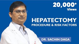 Hepatectomy Procedure and Risk Factors  Medicover Hospitals [upl. by Noeled]