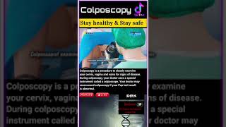 Colposcopy [upl. by Drais373]