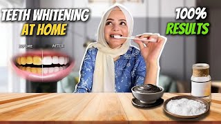 Teeth Whitening At Home  Guaranteed Results  No More Yellow Teeth  Dietitian Aqsa [upl. by Eednac]