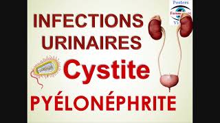 Infection renale Urinaire cystite pyélonéphrite chez enfant Symptômes Diagnostic Traitement [upl. by Yaron397]