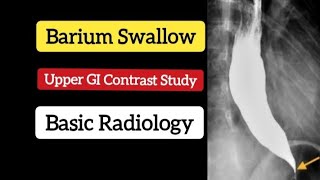 Barium swallow  Upper GI contrast study  Basic Radiology [upl. by Ericka173]