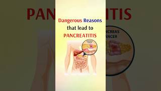 Dangerous reasons that lead to pancreatitis shorts [upl. by Michigan]