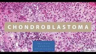 Chondroblastoma [upl. by Ballou]