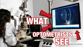 Pt4 Ophthalmic slit lamp Goldmann Posterior seg amp Retina  Optometry Clinical Skills Examination [upl. by Oran154]