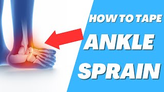 How to tape ankle sprain [upl. by Buine]