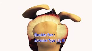 Acromion Types I II II  The Definitive Guide [upl. by Sherj52]