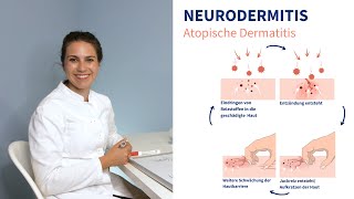 Neurodermitis  Ärztin erklärt worauf man achten sollte [upl. by Nerradal195]